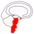 Tronco Cerebral Ectodermo Arcaico
