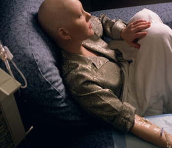 Quimioterapia Medicina Oficial Mujer Callva Cancer Tumor