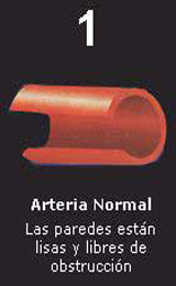Paso 1 Acumulacion Colesterol Arteria Normal