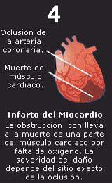 Paso 4 Acumulacion Colesterol Arteria Coronaria Oclusion Infarto Miocardio Muerte
