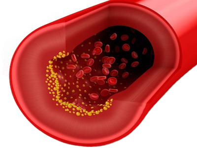 Colesterol Sangre Globulos Rojos Flujo Arterial