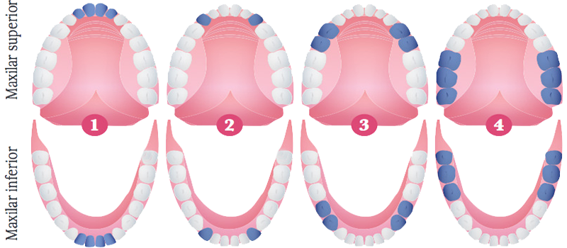 Distribucion Dientes Maxilar Superior Inferior