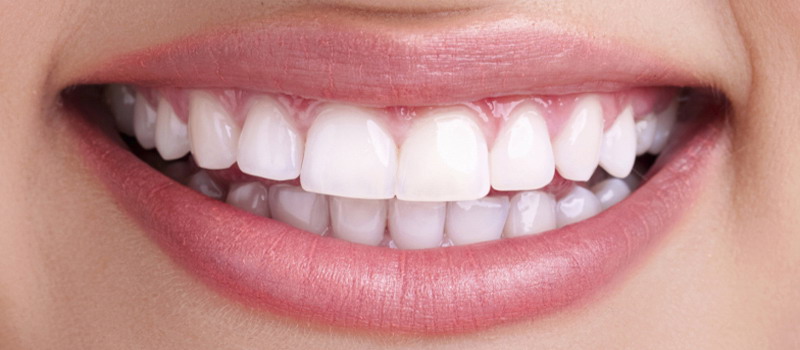 Sonrisa Bella Mujer Dientes Esmalte Blanco Labios Carnosos Rojos
