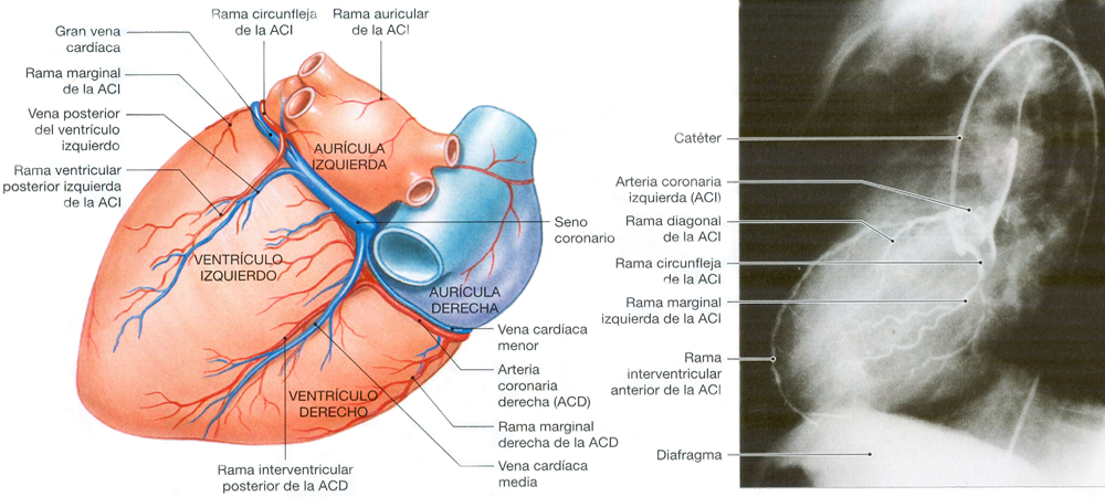 Corazon Arterias Venas Coronarias Auriculas Ventriculos Radiografia