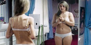 Chica Alucinaciones Visuales Delgada Espejo Gorda Constelacion Cerebral Anorexica Grave