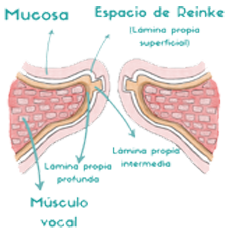 Cuerdas Vocales Fonacion Musculo Vocal Mucosa Espacio Reinke