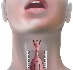 Laringe Cuerdas Vocales Fonacion Movimiento Hablar