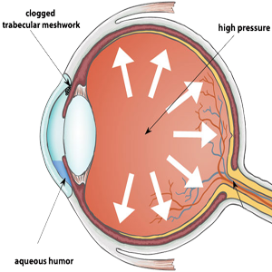 Ojo PIO Presion Intraocular Humor Vitreo Acuoso