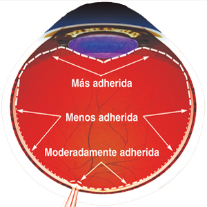 Ojo Cuerpo Humor Vitreo Adherencia Retina Zonas Ectodermo