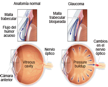 Circulacion Humor Acuoso Ojo Cuerpo Vitreo Malla Trabecular Camaras Anterior Posterior Presion Ocular PIO Nervio Optico