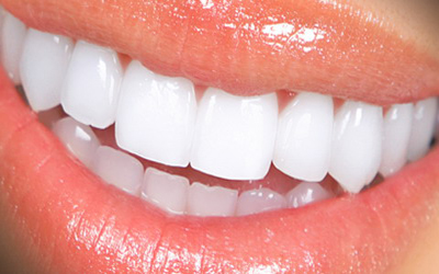 Dientes Blancos Esmalte Labios Sonrisa