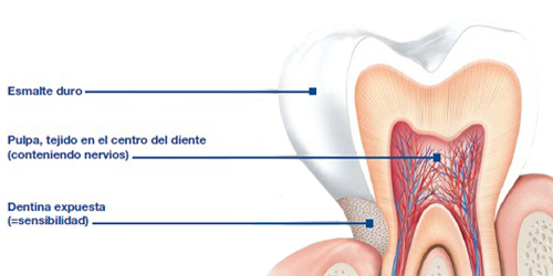Diente Anatomia Esmalte Pulpa Dentina Expuesta