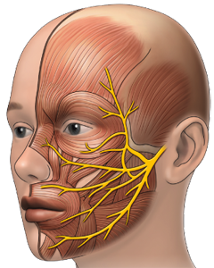 Nervio Trigemino Neuralgia Dolor Cara Cabeza Ectodermo