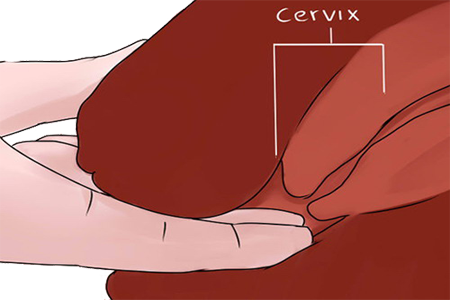 Tacto Dedos Vagina Cuello Utero Cervix Ectodermo