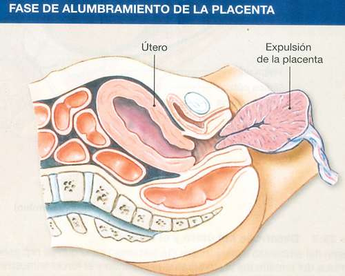 Etapas Parto Alumbramiento Fase Expulsion Placenta