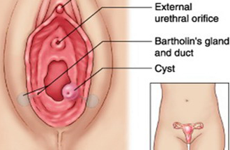 Vulva Vestibulo Vagina Uretra Orificio Glandulas Bartholin Conducto