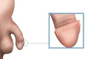 Pene Glandulas Tyson Productoras Esmegma