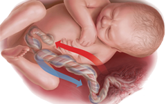 Ombligo Cordon Umbilical Bebe Feto Endodermo