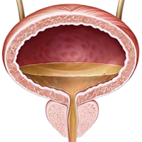 Vejiga Orina Almacenada