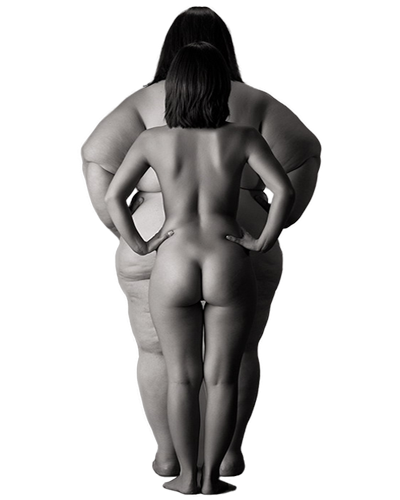 Sobrepeso Obesidad Comparacion Mujeres Espalda Retencion Liquidos