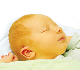 Bebe Piel Amarillenta Nacimiento Ictericia Neonatal