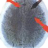 Blog Nueva Medicina Germanica Articulos NMG Hamer Leyes Biologicas