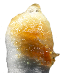 Glandulas Ceruminosas Cerumen Cotonete