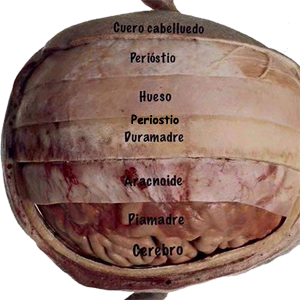 Recubrimientos Cerebro Meninges Hueso Periostio Cuero Cabelludo