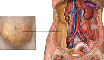 Peritoneo Mesodermo Antiguo Anatomia
