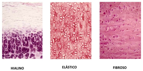 Tipós Cartilagos Hialino Elastico Fibroso Mesodermo Nuevo
