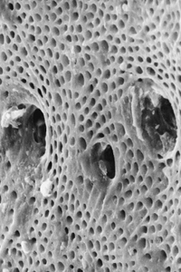 Diente Dentina Hueso Dental Detalles Mesodermo Nuevo