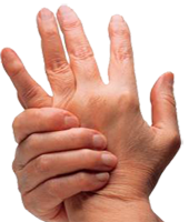 Dolor Artritis Articulacion Mano Muñeca Mesodermo Nuevo