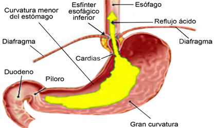 Musculo Diafragma Esfinter Cardias Esofago Estomago Reflujo Mesodermo Nuevo