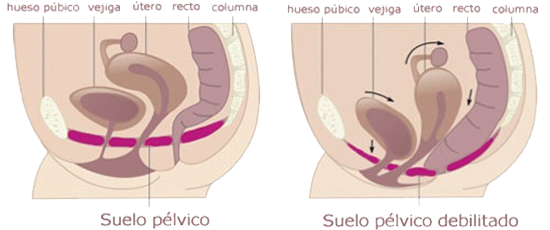 Suelo Pelvico Femenino Debilitado Prolapsos Organos Mesodermo Nuevo