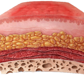 Tejido Adiposo Graso Piel Hipodermis Mesodermo Nuevo
