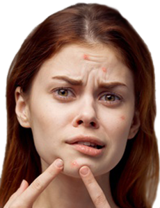 Tejido Adiposo Grasa Espinilla Acne Grano Barro Mesodermo Nuevo