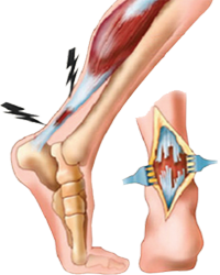 Escuela Leyes Biologicas Pasadofuturo.com Leyesbiologicas.com Mesodermo Nuevo Desvalorizacion Leve Tendones Ligamentos