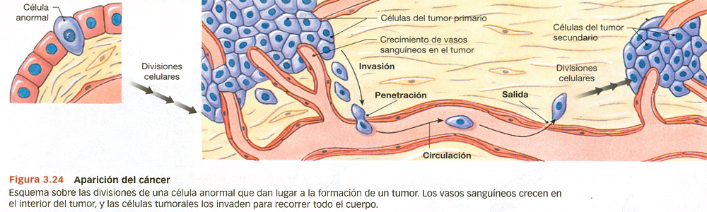 Metastasis Cancer Tumor Primario Secundario