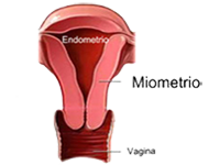 Utero Miometrio Endometrio Vagina