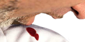 Hombre Sangrando Boca Hemorragia Escupiendo Sangre