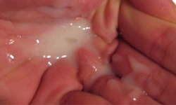 Eyaculacion Semen Mano