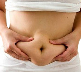 Acumulacion Grasa Vientre Lonjas Sobrepeso Obesidad