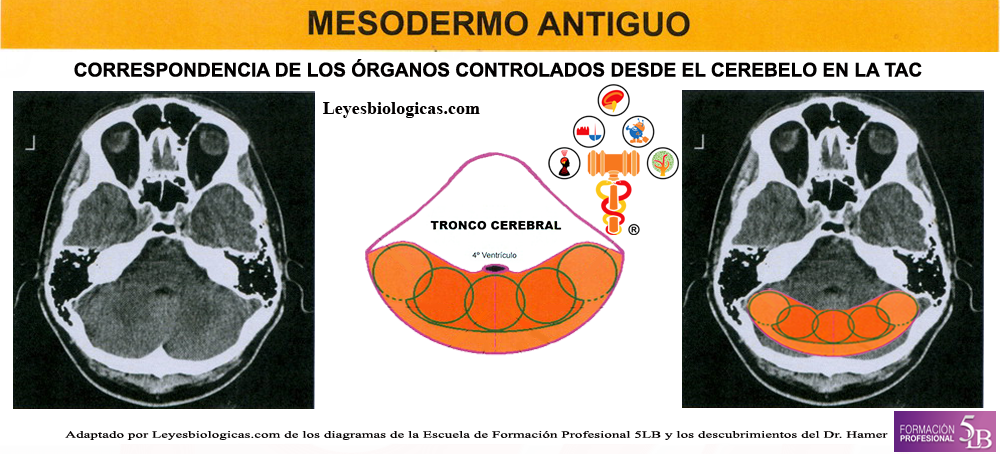 TAC Tomografia Axial Computarizada Cerebelo Reles Mesodermo Antiguo