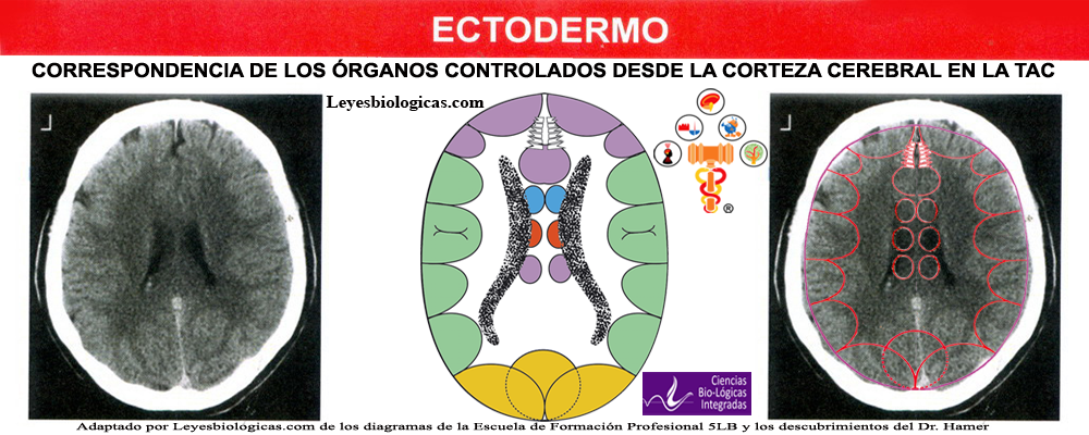 TAC Tomografia Axial Computarizada Corteza Cerebral Reles Ectodermo