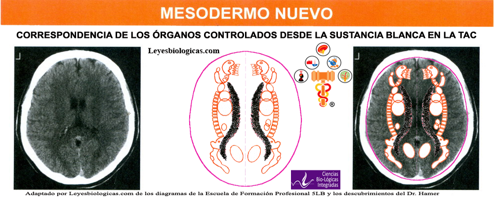 TAC Tomografia Axial Computarizada Sustancia Blanca Medula Cerebral Reles Mesodermo Nuevo