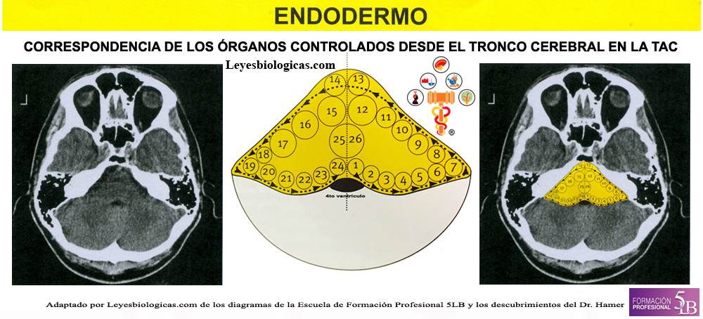 TAC Tomografia Axial Computarizada Tronco Tallo Cerebral Reles Endodermo