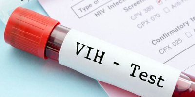 VIH Test SIDA